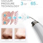 Vacuum Blackhead Remover Cleaner – Pore Cleaning and Skin Care Tool - Image 4
