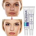 Bioaqua Anti-Acne Scar Mark Removal Cream – Restore Smooth, Clear, and Radiant Skin